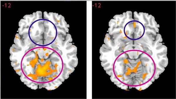 https://cdn.ncbi.nlm.nih.gov/pmc/blobs/1e14/5551501/10ce465e1dce/nihms883957f5.jpg