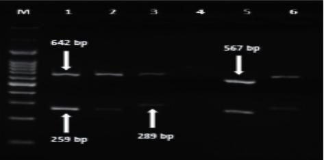 https://cdn.ncbi.nlm.nih.gov/pmc/blobs/1e1c/8263242/4ac2664ce10d/ijmicro2021-5540560.008.jpg