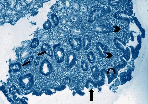 https://cdn.ncbi.nlm.nih.gov/pmc/blobs/1e1c/8263242/94f90002ee95/ijmicro2021-5540560.004.jpg