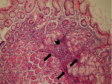 https://cdn.ncbi.nlm.nih.gov/pmc/blobs/1e1c/8263242/95bd893b9ef4/ijmicro2021-5540560.006.jpg