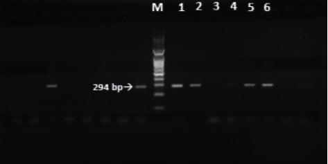 https://cdn.ncbi.nlm.nih.gov/pmc/blobs/1e1c/8263242/965eb6aed9f5/ijmicro2021-5540560.007.jpg
