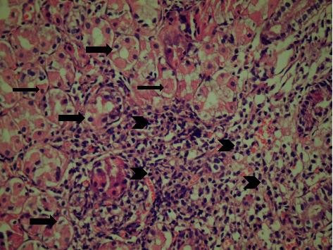 https://cdn.ncbi.nlm.nih.gov/pmc/blobs/1e1c/8263242/a3e378b67cfb/ijmicro2021-5540560.002.jpg