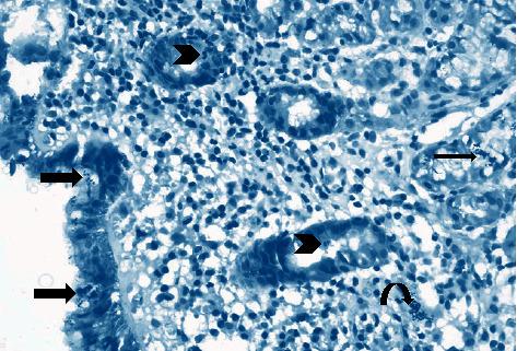 https://cdn.ncbi.nlm.nih.gov/pmc/blobs/1e1c/8263242/d78f49ca1f5b/ijmicro2021-5540560.003.jpg