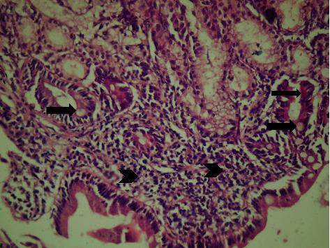 https://cdn.ncbi.nlm.nih.gov/pmc/blobs/1e1c/8263242/daa4be7e2020/ijmicro2021-5540560.001.jpg