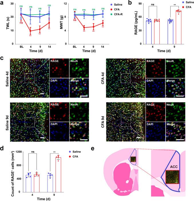 https://cdn.ncbi.nlm.nih.gov/pmc/blobs/1e20/12078453/0ec49af3ce2d/12035_2025_4713_Fig1_HTML.jpg