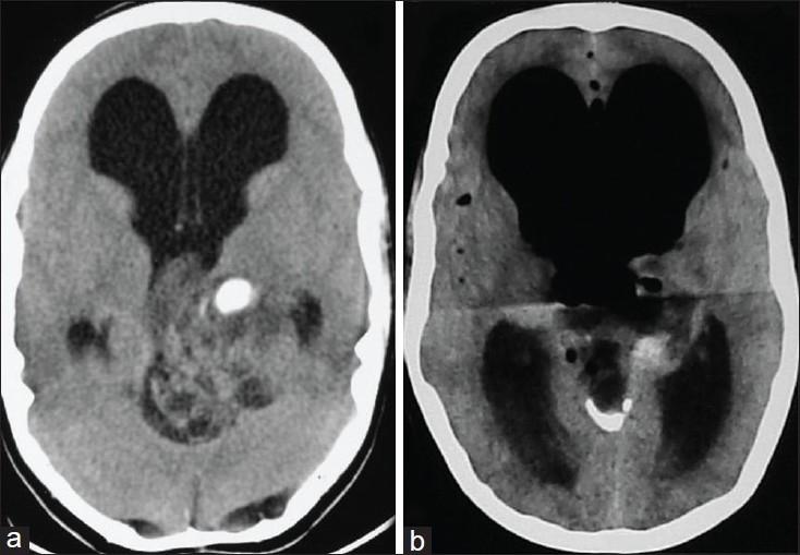 https://cdn.ncbi.nlm.nih.gov/pmc/blobs/1e2a/3161477/d43fe38a8db3/JOACP-27-409-g001.jpg