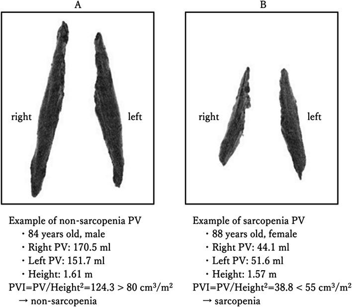 https://cdn.ncbi.nlm.nih.gov/pmc/blobs/1e2d/11184714/a43053fd6545/12885_2024_12524_Fig1_HTML.jpg