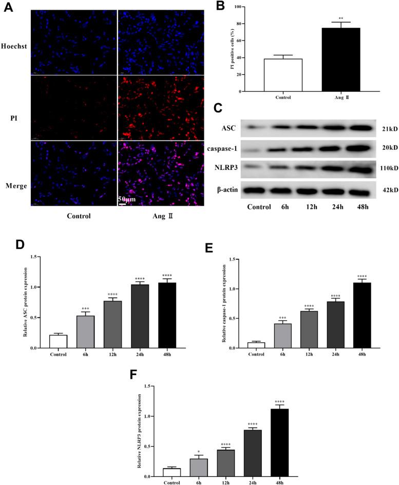 https://cdn.ncbi.nlm.nih.gov/pmc/blobs/1e37/12334731/4986a44ac355/41598_2025_14268_Fig5_HTML.jpg