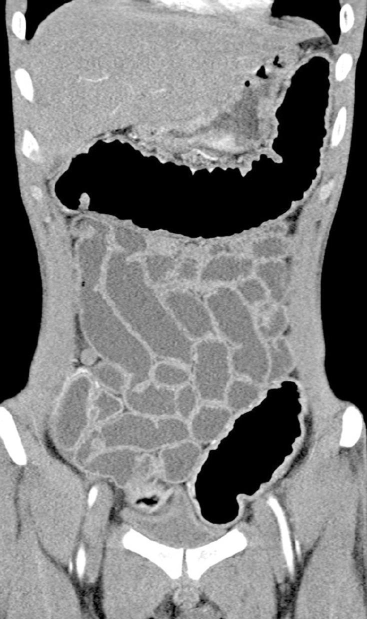 https://cdn.ncbi.nlm.nih.gov/pmc/blobs/1e37/7479559/5de3e479c921/WJCC-8-3847-g003.jpg