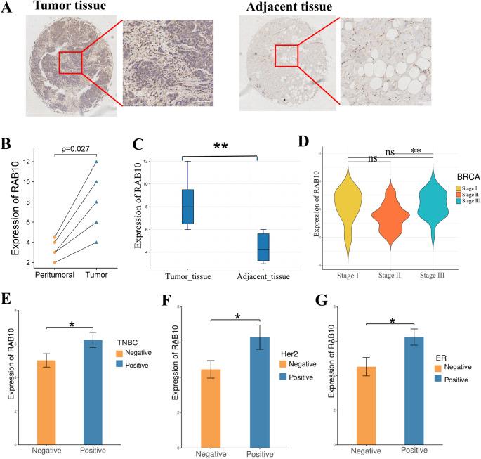 https://cdn.ncbi.nlm.nih.gov/pmc/blobs/1e39/12259503/0bce05228b6d/18_2025_5788_Fig2_HTML.jpg