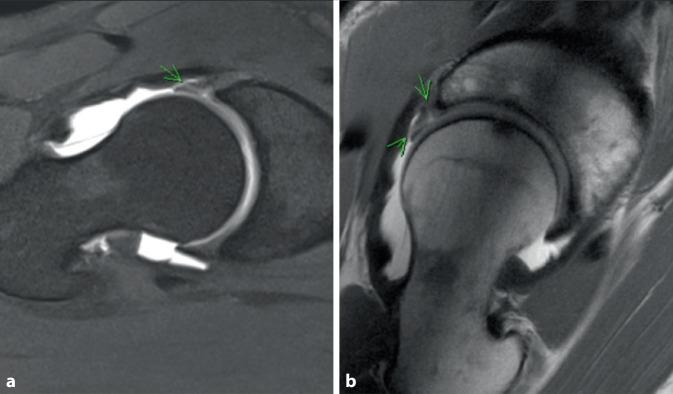 https://cdn.ncbi.nlm.nih.gov/pmc/blobs/1e3b/10477097/87dff189efb1/132_2023_4399_Fig1_HTML.jpg