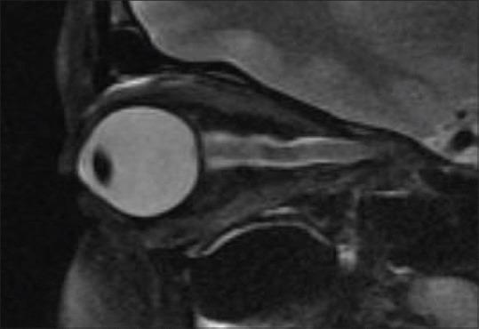 https://cdn.ncbi.nlm.nih.gov/pmc/blobs/1e3e/4693393/2a473ec116cc/IJRI-25-439-g005.jpg
