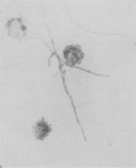 https://cdn.ncbi.nlm.nih.gov/pmc/blobs/1e4b/1824134/593d1d97e025/canmedaj00768-0027-c.jpg