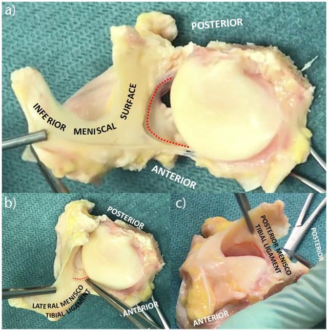 https://cdn.ncbi.nlm.nih.gov/pmc/blobs/1e4f/7845568/58ba6c6fa26d/eor-6-61-g003.jpg