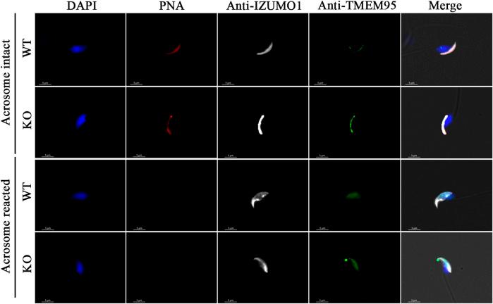 https://cdn.ncbi.nlm.nih.gov/pmc/blobs/1e50/9204177/bd86885f9c27/fcell-10-854115-g004.jpg