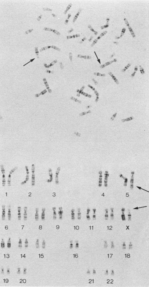 https://cdn.ncbi.nlm.nih.gov/pmc/blobs/1e52/1685082/a9582aaac3cb/ajhg00364-0023-a.jpg