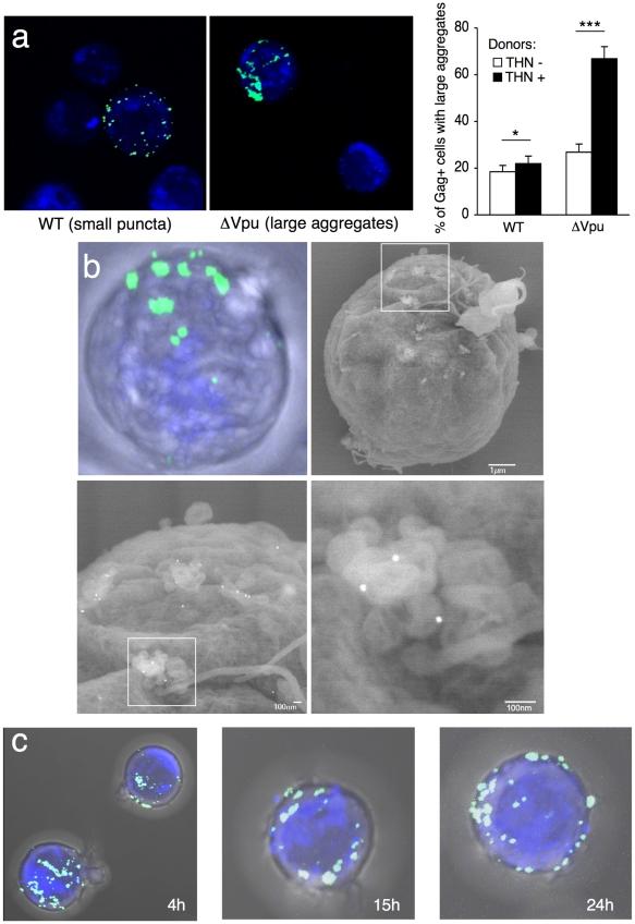https://cdn.ncbi.nlm.nih.gov/pmc/blobs/1e52/2887479/2ae7f22cf84a/ppat.1000955.g004.jpg