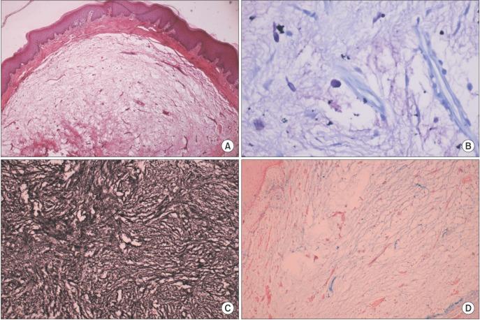 https://cdn.ncbi.nlm.nih.gov/pmc/blobs/1e5a/5529192/390bbafd6c31/jkaoms-43-178-g002.jpg
