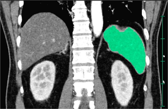 https://cdn.ncbi.nlm.nih.gov/pmc/blobs/1e5b/8535436/5c37654fe382/AMS2-8-e698-g002.jpg