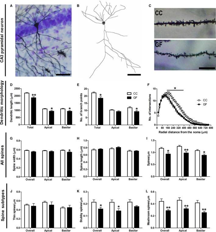 https://cdn.ncbi.nlm.nih.gov/pmc/blobs/1e64/5113767/0a75c80827ad/EJN-44-2654-g004.jpg