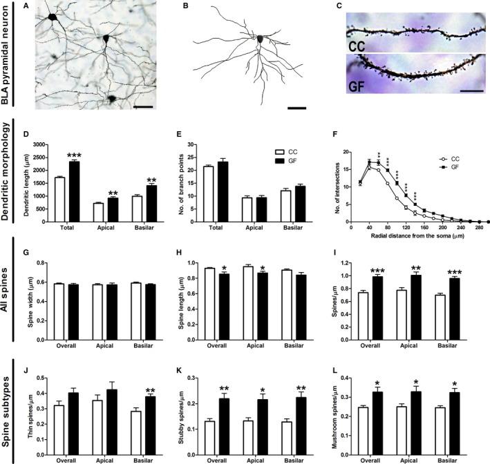 https://cdn.ncbi.nlm.nih.gov/pmc/blobs/1e64/5113767/34abf6feaffe/EJN-44-2654-g003.jpg