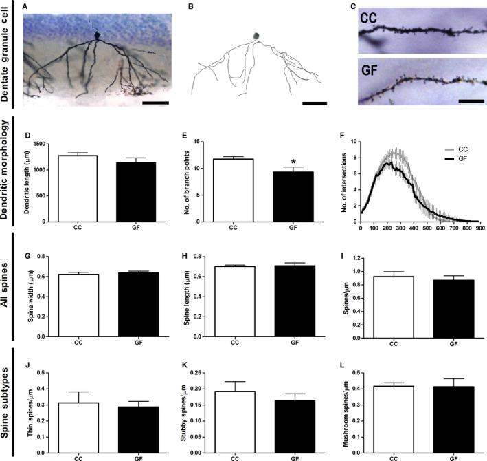 https://cdn.ncbi.nlm.nih.gov/pmc/blobs/1e64/5113767/4c2c2eab7804/EJN-44-2654-g005.jpg
