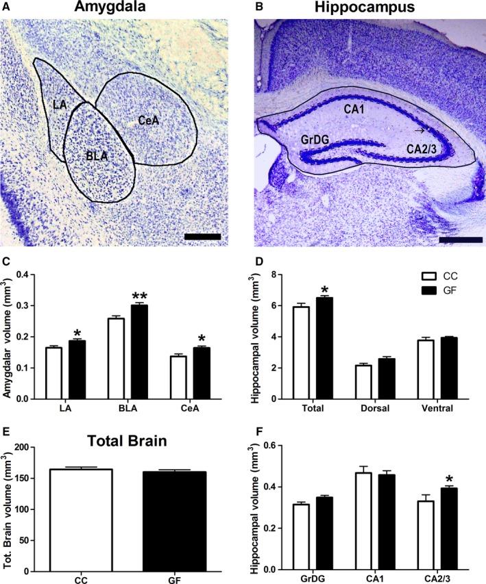 https://cdn.ncbi.nlm.nih.gov/pmc/blobs/1e64/5113767/cd452201f4db/EJN-44-2654-g001.jpg