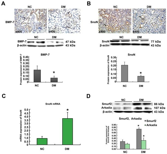 https://cdn.ncbi.nlm.nih.gov/pmc/blobs/1e6c/5548011/bf69d1821f81/MMR-16-03-3308-g01.jpg