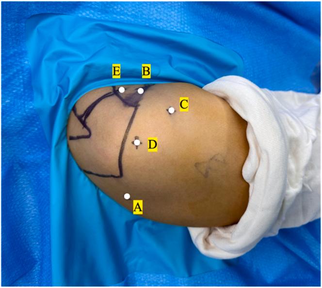https://cdn.ncbi.nlm.nih.gov/pmc/blobs/1e6f/12177477/8d4240069125/gr1.jpg