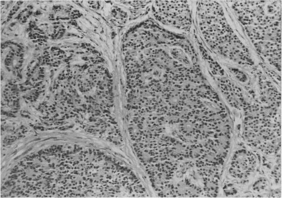 https://cdn.ncbi.nlm.nih.gov/pmc/blobs/1e6f/1552989/1b32779dc514/gut00700-0046-b.jpg