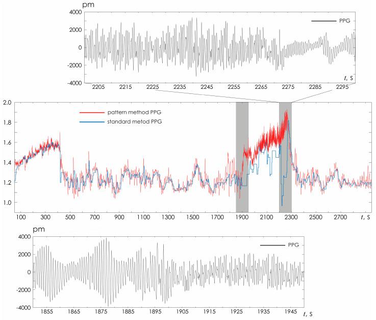 https://cdn.ncbi.nlm.nih.gov/pmc/blobs/1e76/12431279/4c20b2c88386/sensors-25-05455-g008.jpg