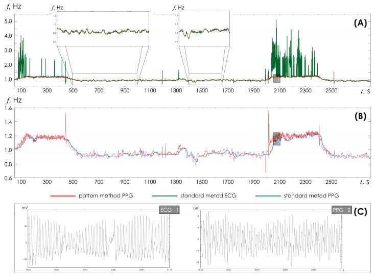 https://cdn.ncbi.nlm.nih.gov/pmc/blobs/1e76/12431279/8c7a7884a7bc/sensors-25-05455-g007.jpg