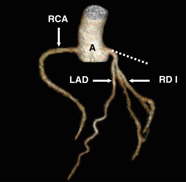 https://cdn.ncbi.nlm.nih.gov/pmc/blobs/1e77/3682927/e273f1a964b8/1746-1596-8-91-2.jpg