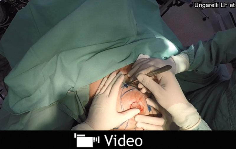 https://cdn.ncbi.nlm.nih.gov/pmc/blobs/1e7d/5293291/2ea934c55b0d/gox-5-e1184-g001.jpg