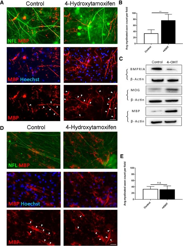 https://cdn.ncbi.nlm.nih.gov/pmc/blobs/1e80/6529590/5f375bf2fef5/enu0021929310008.jpg