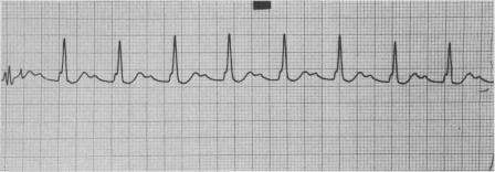 https://cdn.ncbi.nlm.nih.gov/pmc/blobs/1e86/1818059/ea8c29a93032/canmedaj01426-0040-a.jpg