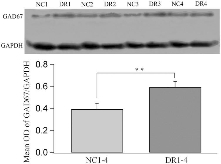 https://cdn.ncbi.nlm.nih.gov/pmc/blobs/1e86/4749323/9301fc9d8551/pone.0149004.g008.jpg
