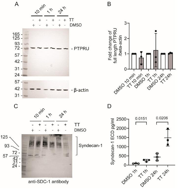 https://cdn.ncbi.nlm.nih.gov/pmc/blobs/1e8d/11171882/ad1685b28951/cells-13-00982-g008.jpg