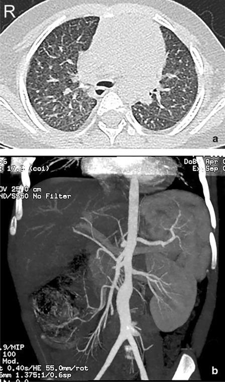 https://cdn.ncbi.nlm.nih.gov/pmc/blobs/1e8d/7597064/ef0e6c3d134c/12985_2020_1409_Fig1_HTML.jpg