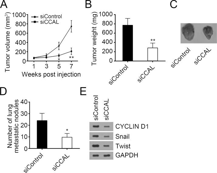 https://cdn.ncbi.nlm.nih.gov/pmc/blobs/1e93/7844649/8a13bb033199/OR-26-1383-g004.jpg