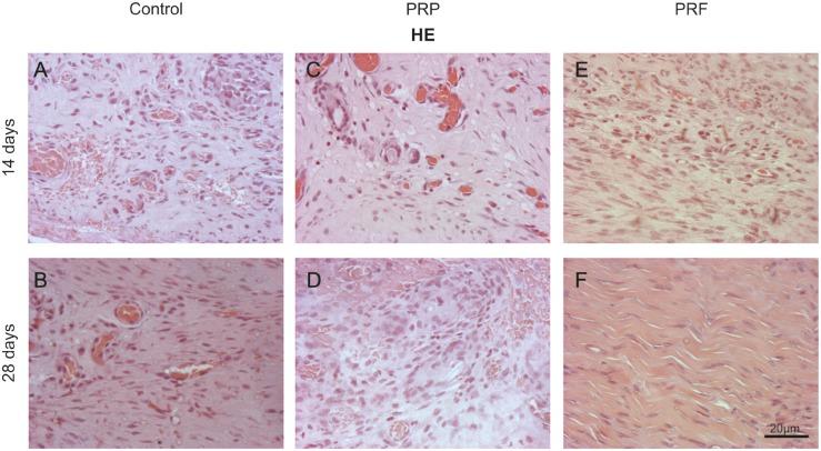 https://cdn.ncbi.nlm.nih.gov/pmc/blobs/1e9c/4537601/d2afd27a6662/wjps-4-101-g005.jpg