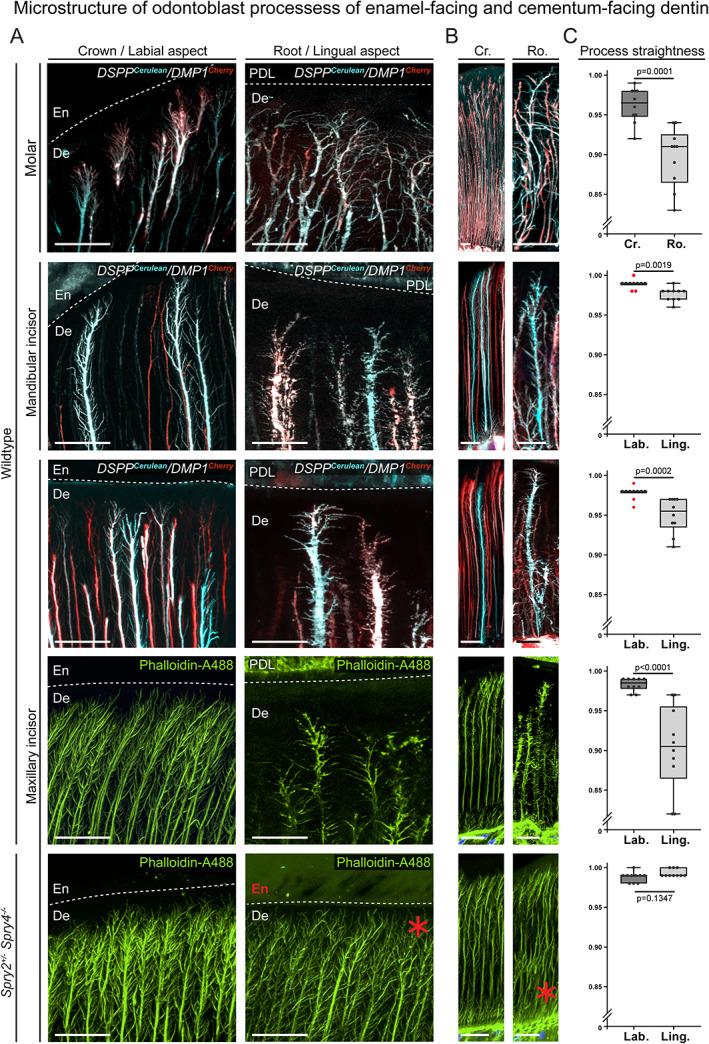 https://cdn.ncbi.nlm.nih.gov/pmc/blobs/1ea0/9300090/10a8a22e963b/JBMR-37-323-g008.jpg