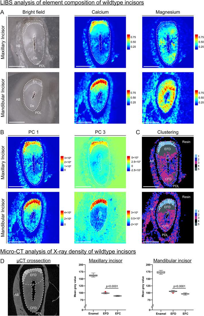 https://cdn.ncbi.nlm.nih.gov/pmc/blobs/1ea0/9300090/a33b2ebac70a/JBMR-37-323-g003.jpg