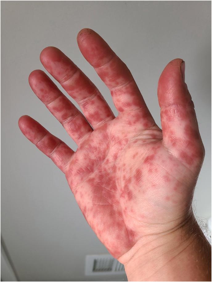 https://cdn.ncbi.nlm.nih.gov/pmc/blobs/1ea4/9792351/1fe289c31ce2/gr5.jpg