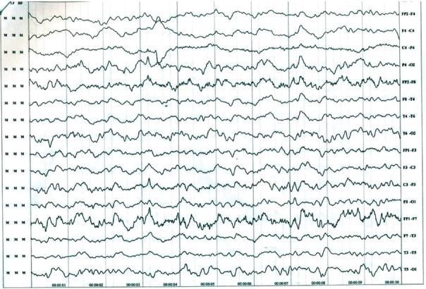 https://cdn.ncbi.nlm.nih.gov/pmc/blobs/1ea8/5590384/c62bbf9da882/IJABMR-7-193-g001.jpg