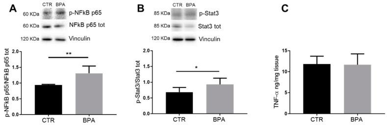 https://cdn.ncbi.nlm.nih.gov/pmc/blobs/1eb8/8227982/8da6f51c8628/nutrients-13-01970-g007.jpg