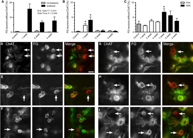 https://cdn.ncbi.nlm.nih.gov/pmc/blobs/1ebf/3031092/2873a8d0c6ca/fnins-05-00006-g003.jpg