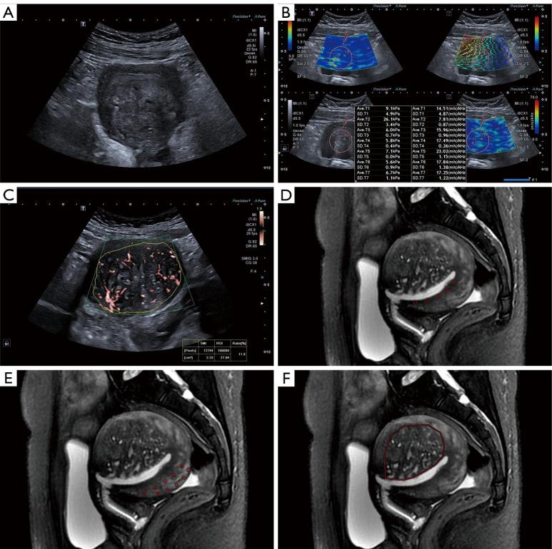 https://cdn.ncbi.nlm.nih.gov/pmc/blobs/1ec2/12332701/bdba7ad37d63/qims-15-08-6923-f2.jpg