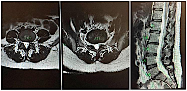https://cdn.ncbi.nlm.nih.gov/pmc/blobs/1ecf/12286087/28aa32ac5a70/jfmk-10-00242-g002.jpg