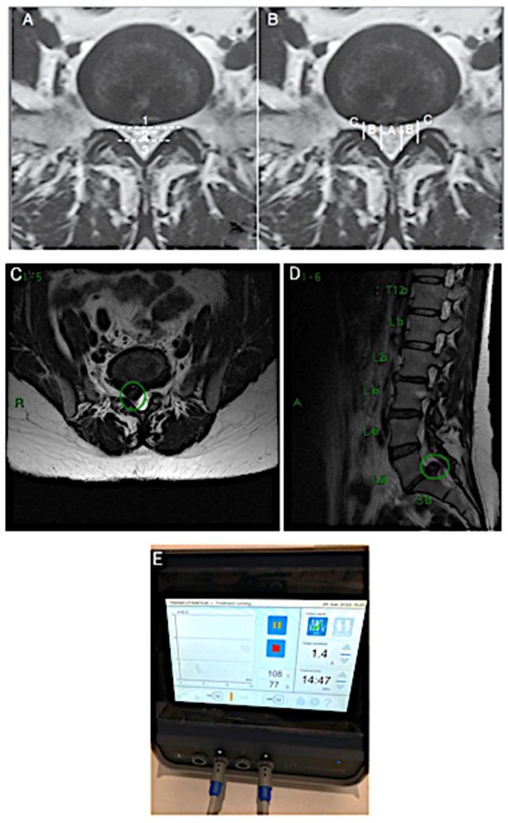 https://cdn.ncbi.nlm.nih.gov/pmc/blobs/1ecf/12286087/413dc8dd4e8f/jfmk-10-00242-g001.jpg